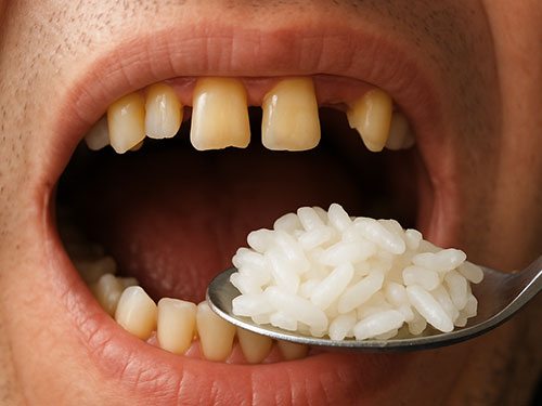 Difficulty Chewing or Speaking